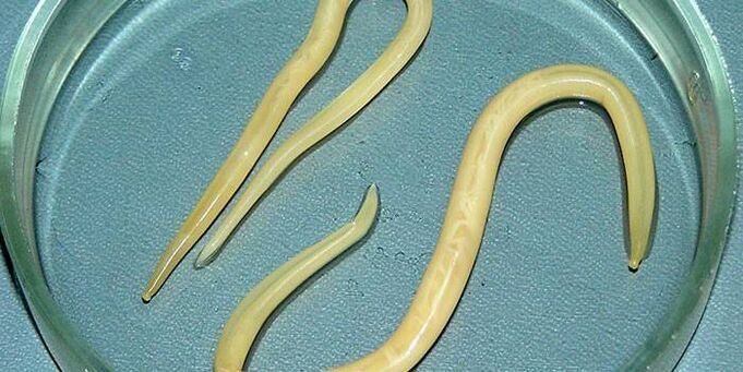 Menschliche Spulwürmer in einer Petrischale parasitieren die Wände des Dünndarms