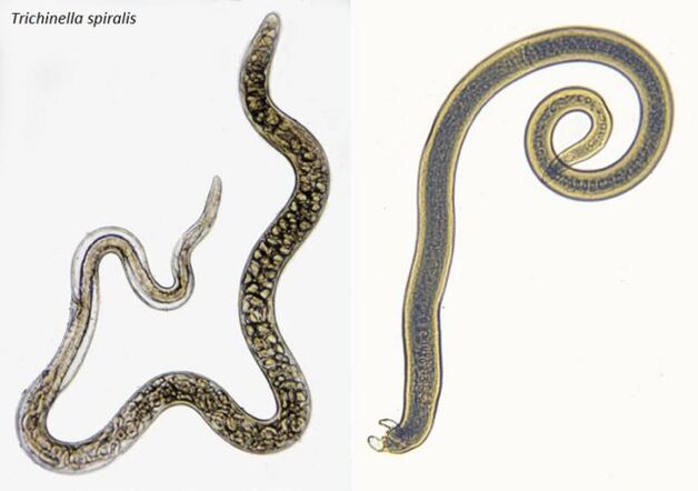 Trichinen